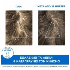 Uriage Ds Hair Kerato-Reducing Treatment Shampoo Σαμπουάν Αγωγής Κατά της Πιτυρίδας, 150ml – φωτογραφία 3